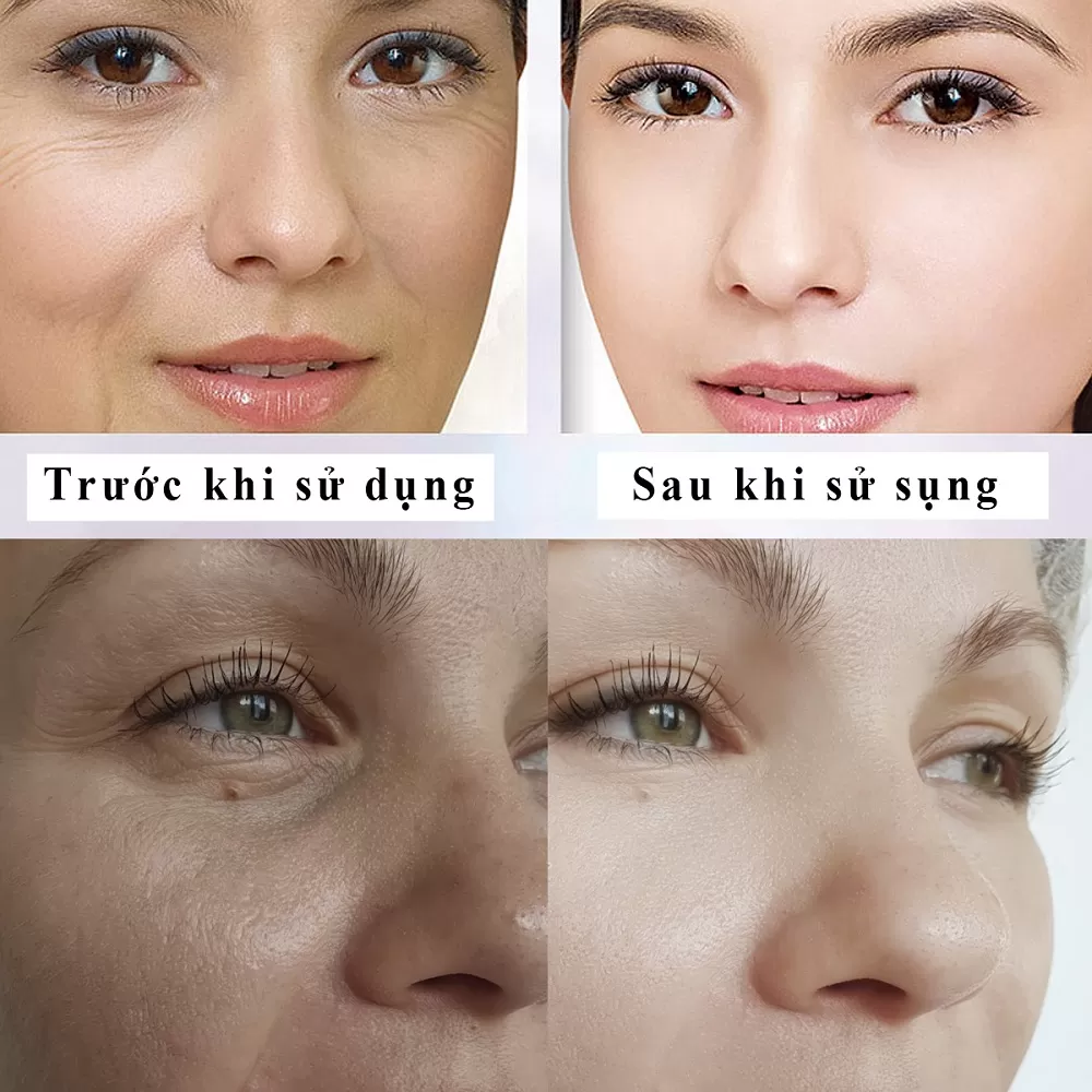 Serum Mờ Nám Sáng Da SKINHDOR