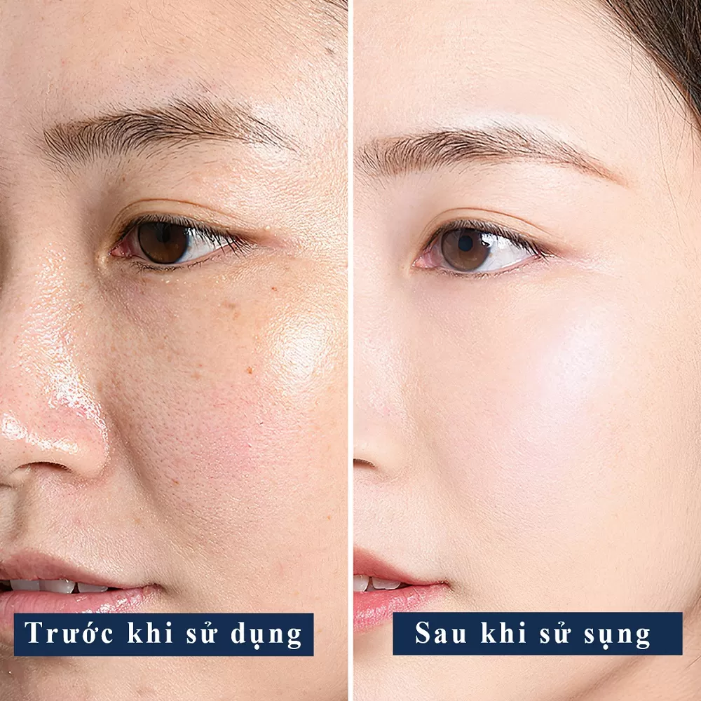 Sữa 8 Lớp Dưỡng Ẩm Phục Hồi Sáng Mịn Da Terisa