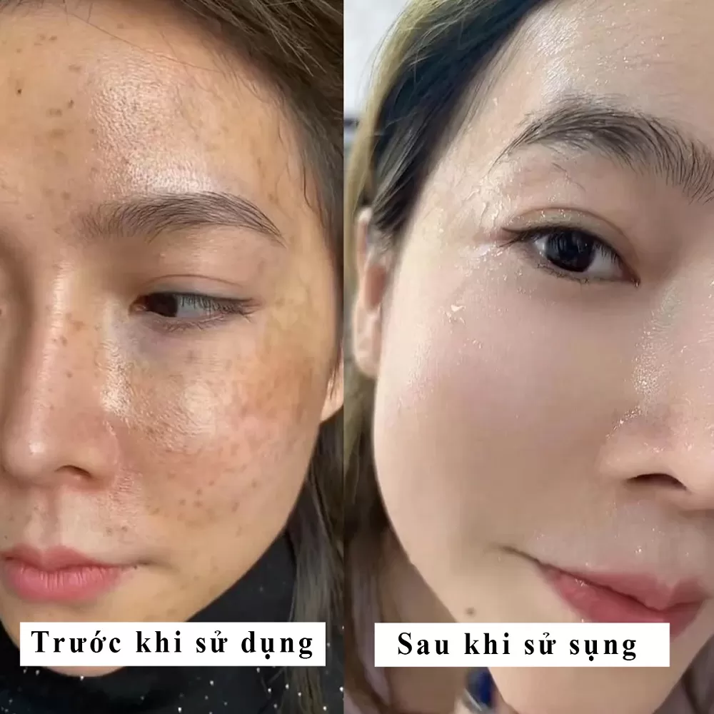 Kem Mờ Nám Sáng Da SKINHDOR